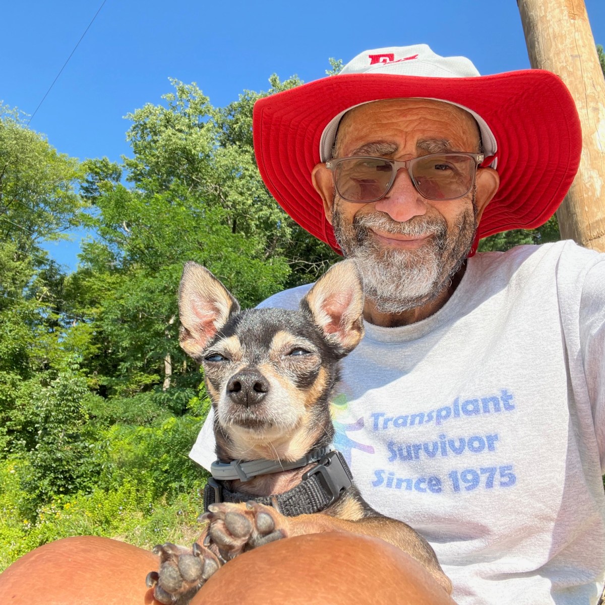 Kidney Transplant Recipient Approaches 50th Transplant Anniversary from Deceased Donor